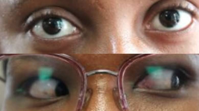 Eye Health Matters: World Glaucoma Week