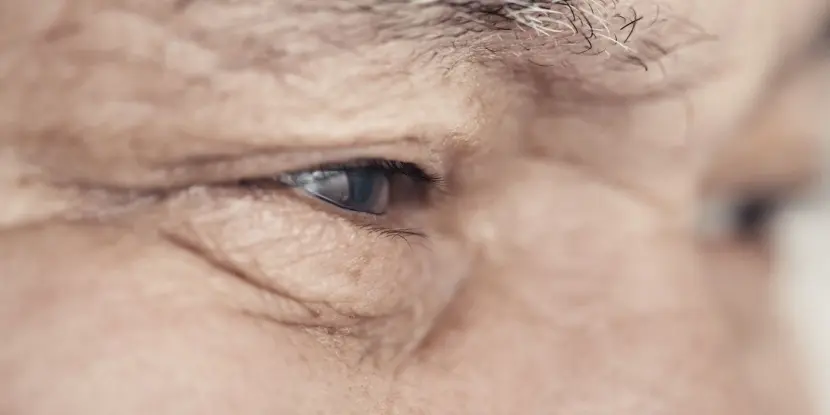 10 Cataract Surgery Side Effects