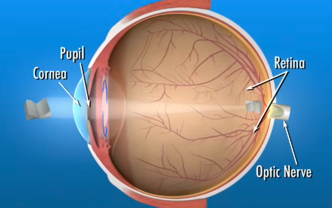 Cataract Surgery: Risks, Recovery, Costs