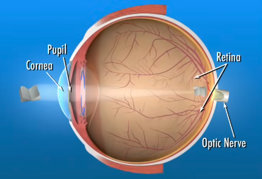 Cataract Surgery: Risks, Recovery, Costs